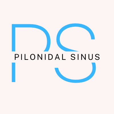 PIlonidal Sinus